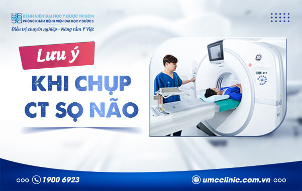 LƯU Ý KHI CHỤP CT SỌ NÃO