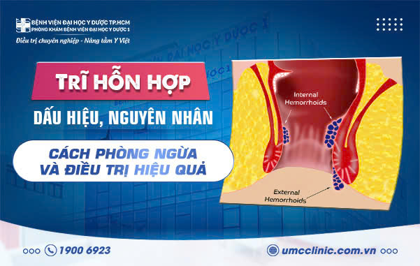 TRĨ HỖN HỢP: DẤU HIỆU, NGUYÊN NHÂN, CÁCH PHÒNG NGỪA VÀ ĐIỀU TRỊ HIỆU QUẢ