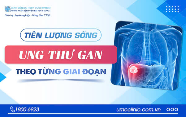UNG THƯ GAN CÓ CHỮA ĐƯỢC KHÔNG? TIÊN LƯỢNG SỐNG UNG THƯ GAN THEO TỪNG GIAI ĐOẠN