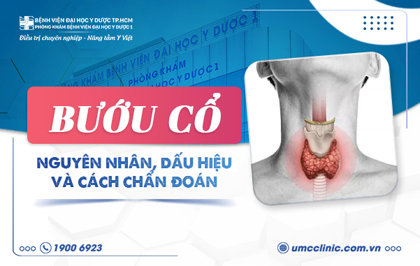 BƯỚU CỔ LÀ GÌ? NGUYÊN NHÂN, DẤU HIỆU VÀ CÁCH CHẨN ĐOÁN