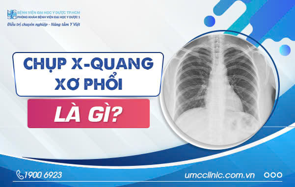 CHỤP X-QUANG XƠ PHỔI LÀ GÌ? KHI NÀO CẦN CHỤP X-QUANG XƠ PHỔI?