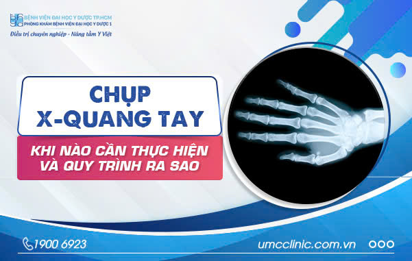 CHỤP X-QUANG TAY: KHI NÀO CẦN THỰC HIỆN VÀ QUY TRÌNH RA SAO?