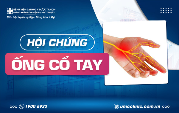 HỘI CHỨNG ỐNG CỔ TAY: NGUYÊN NHÂN, TRIỆU CHỨNG VÀ PHƯƠNG PHÁP ĐIỀU TRỊ