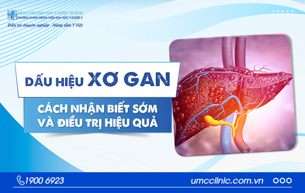 DẤU HIỆU XƠ GAN: CÁCH NHẬN BIẾT SỚM VÀ ĐIỀU TRỊ HIỆU QUẢ