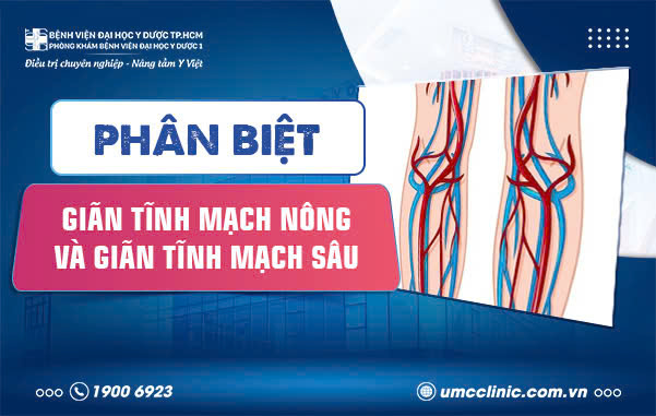 PHÂN BIỆT GIÃN TĨNH MẠCH NÔNG VÀ GIÃN TĨNH MẠCH SÂU