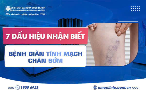 7 DẤU HIỆU NHẬN BIẾT BỆNH GIÃN TĨNH MẠCH CHÂN SỚM