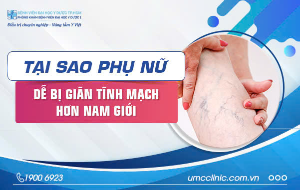 TẠI SAO PHỤ NỮ DỄ BỊ GIÃN TĨNH MẠCH HƠN NAM GIỚI?