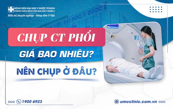 CHỤP CT PHỔI GIÁ BAO NHIÊU? NÊN CHỤP Ở ĐÂU?