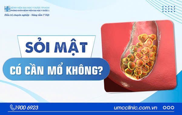 TẠI SAO BỊ SỎI MẬT? SỎI MẬT CÓ CẦN MỔ KHÔNG?