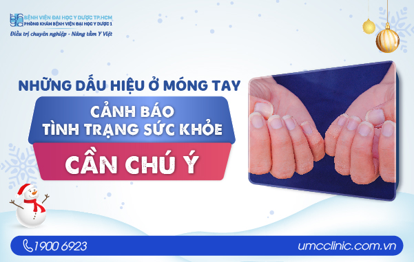 NHỮNG DẤU HIỆU Ở MÓNG TAY CẢNH BÁO TÌNH TRẠNG SỨC KHỎE CẦN CHÚ Ý