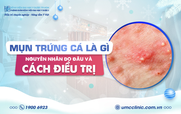 MỤN TRỨNG CÁ LÀ GÌ? NGUYÊN NHÂN DO ĐÂU VÀ CÁCH ĐIỀU TRỊ HIỆU QUẢ