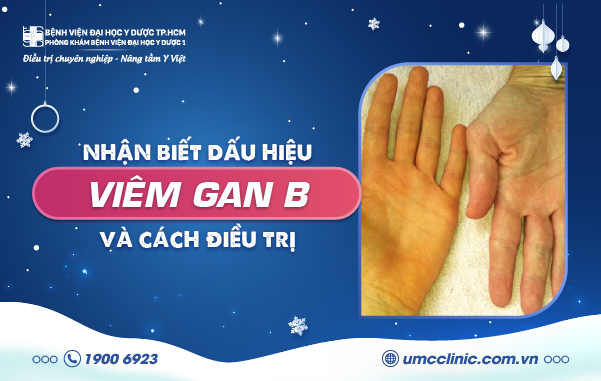 NHẬN BIẾT DẤU HIỆU VIÊM GAN B VÀ CÁCH ĐIỀU TRỊ