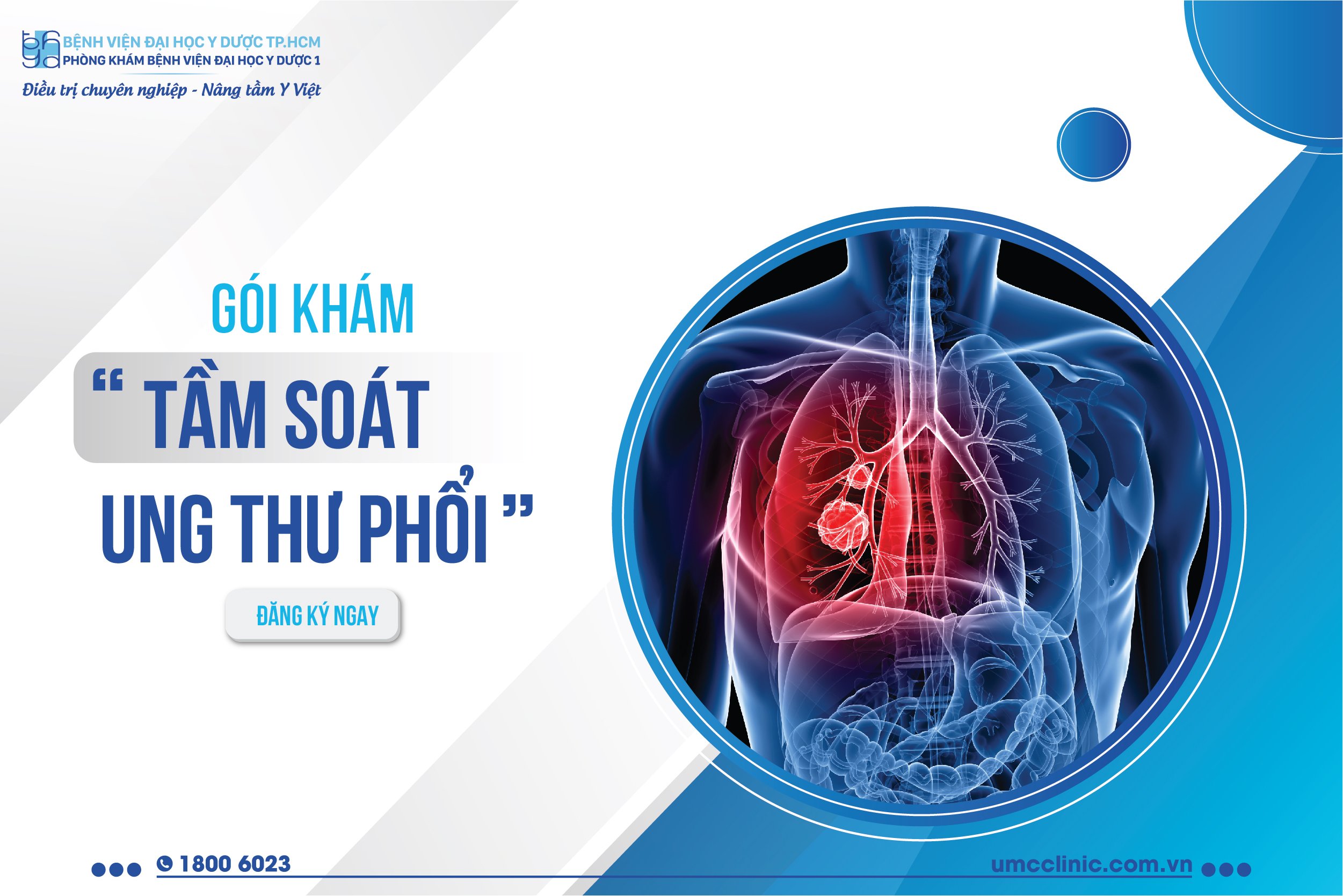 GÓI KHÁM TẦM SOÁT UNG THƯ PHỔI
