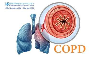 BỆNH PHỔI TẮC NGHẼN MẠN TÍNH (COPD) | CÁCH ĐIỀU TRỊ VÀ PHÒNG NGỪA