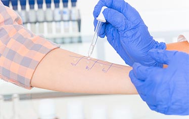 XÉT NGHIỆM NHẬN BIẾT NGUYÊN NHÂN DỊ ỨNG BẠN CẦN BIẾT