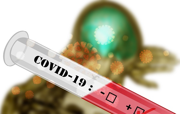 Xét nghiệm RT-PCR phương pháp chẩn đoán Covid-19 hiệu quả