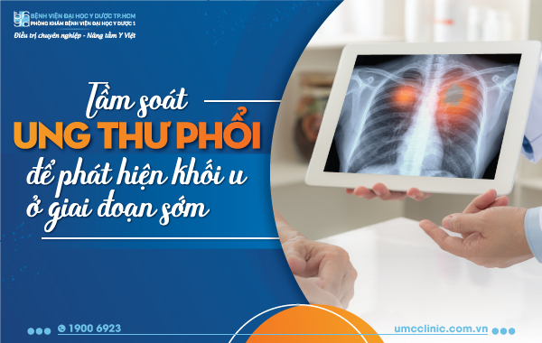 TẦM SOÁT UNG THƯ PHỔI ĐỂ PHÁT HIỆN KHỐI U Ở GIAI ĐOẠN SỚM