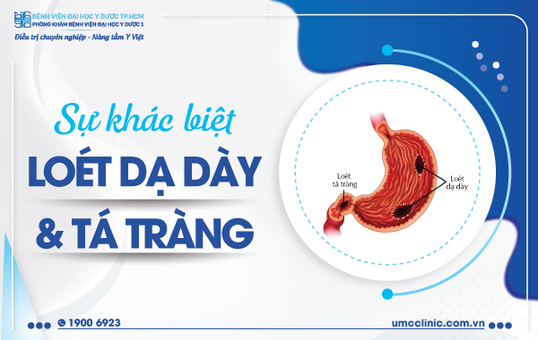 SỰ KHÁC BIỆT GIỮA LOÉT DẠ DÀY VÀ LOÉT TÁ TRÀNG LÀ GÌ?