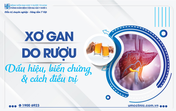 XƠ GAN DO RƯỢU: DẤU HIỆU, BIẾN  CHỨNG VÀ CÁCH ĐIỀU TRỊ