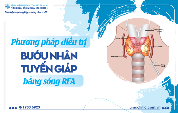 PHƯƠNG PHÁP ĐIỀU TRỊ BƯỚU NHÂN TUYẾN GIÁP (BƯỚU CỔ) BẰNG SÓNG RFA