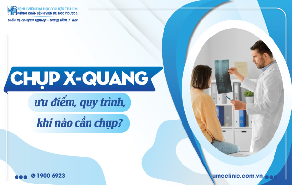 CHỤP X-QUANG: ƯU ĐIỂM, HẠN CHẾ, KHI NÀO CẦN CHỤP?
