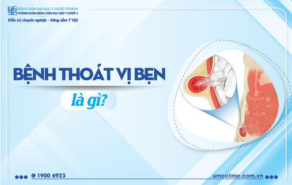 BỆNH THOÁT VỊ BẸN LÀ GÌ?