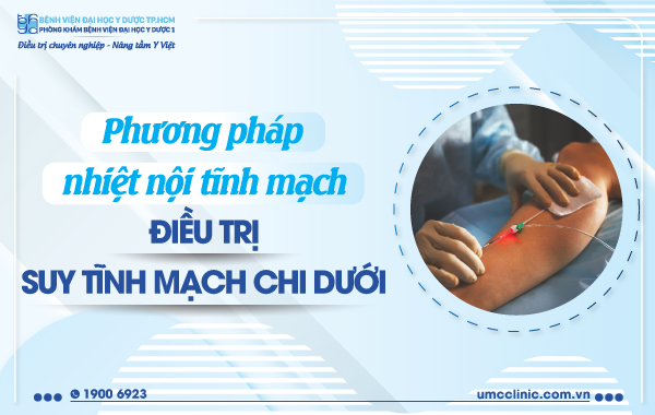 PHƯƠNG PHÁP NHIỆT NỘI TĨNH MẠCH ĐIỀU TRỊ SUY TĨNH MẠCH CHI DƯỚI