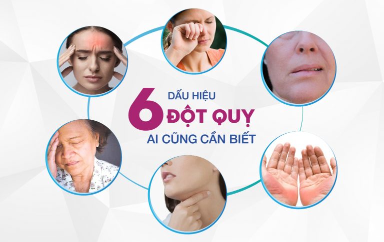 6 DẤU HIỆU ĐỘT QUỴ AI CŨNG CẦN BIẾT