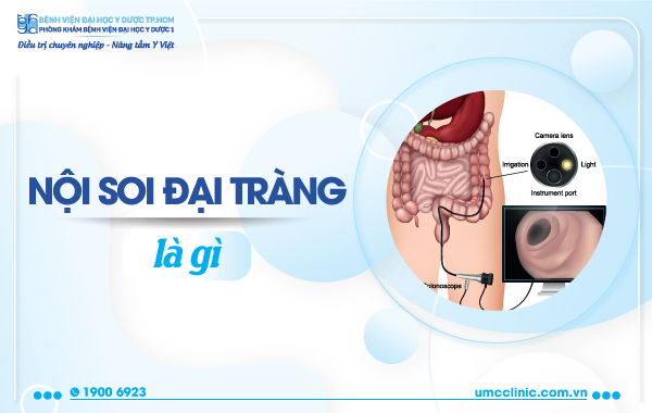 NỘI SOI ĐẠI TRÀNG LÀ GÌ?