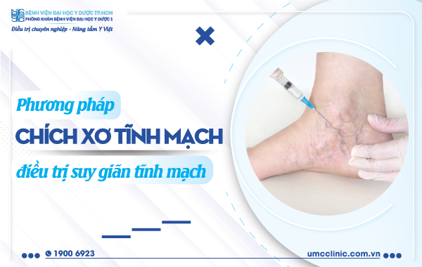 PHƯƠNG PHÁP CHÍCH XƠ TĨNH MẠCH ĐIỀU TRỊ SUY GIÃN TĨNH MẠCH
