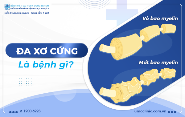 ĐA XƠ CỨNG LÀ BỆNH GÌ?