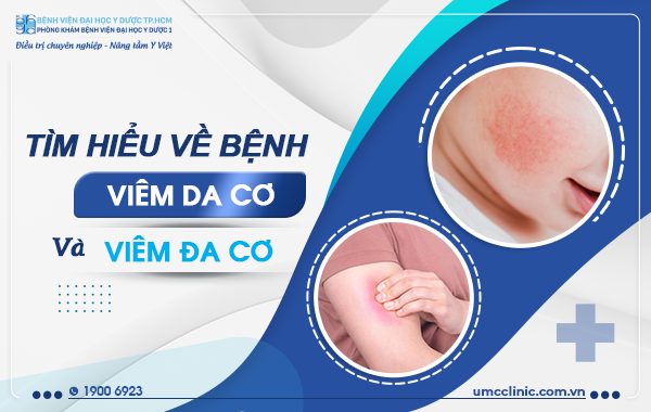 TÌM HIỂU VỀ BỆNH VIÊM DA CƠ VÀ VIÊM ĐA CƠ