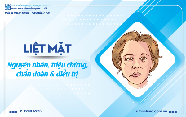 LIỆT MẶT: NGUYÊN NHÂN, TRIỆU CHỨNG, CHẨN ĐOÁN VÀ ĐIỀU TRỊ