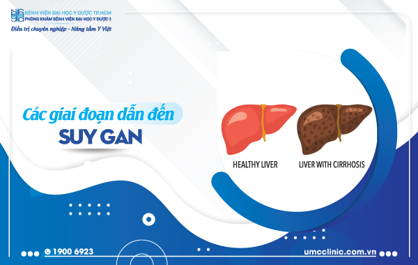 CÁC GIAI ĐOẠN DẪN ĐẾN SUY GAN