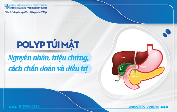 POLYP TÚI MẬT: NGUYÊN NHÂN, TRIỆU CHỨNG, CÁCH CHẨN ĐOÁN VÀ ĐIỀU TRỊ