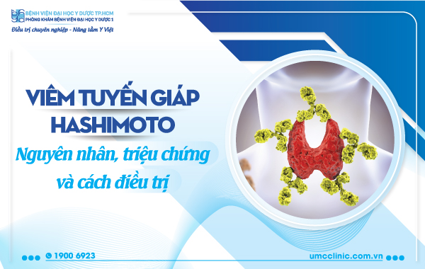 VIÊM TUYẾN GIÁP HASHIMOTO: NGUYÊN NHÂN, TRIỆU CHỨNG VÀ CÁCH ĐIỀU TRỊ