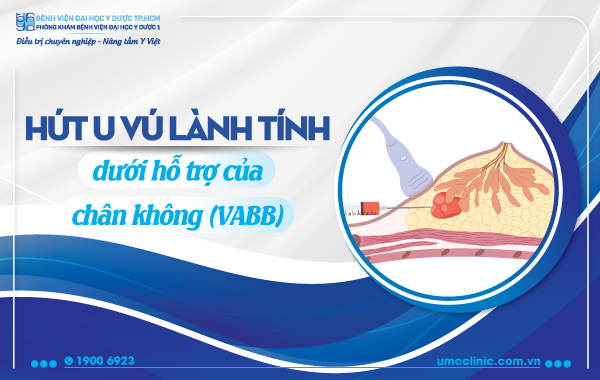 HÚT U VÚ LÀNH TÍNH DƯỚI HỖ TRỢ CỦA CHÂN KHÔNG (VABB)