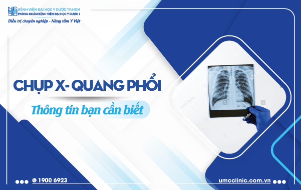 CHỤP X-QUANG PHỔI: THÔNG TIN BẠN CẦN BIẾT