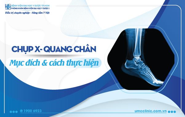 CHỤP X-QUANG CHÂN: MỤC ĐÍCH VÀ CÁCH THỰC HIỆN