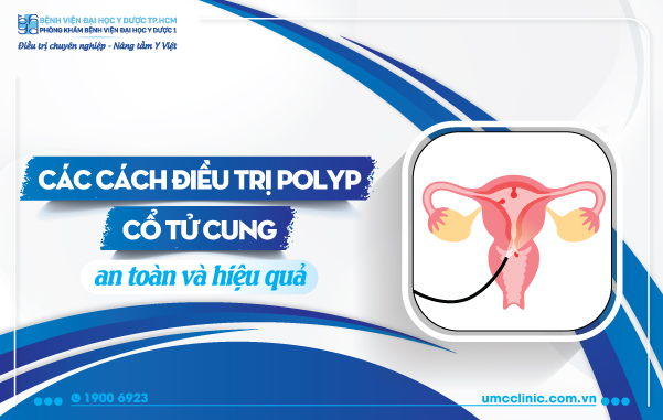 CÁCH ĐIỀU TRỊ POLYP CỔ TỬ CUNG AN TOÀN VÀ HIỆU QUẢ
