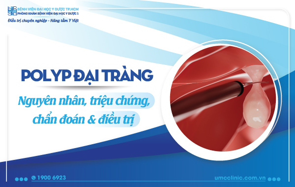 POLYP ĐẠI TRÀNG: NGUYÊN NHÂN, TRIỆU CHỨNG, CHẨN ĐOÁN VÀ ĐIỀU TRỊ