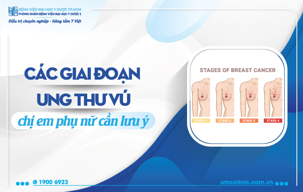 CÁC GIAI ĐOẠN UNG THƯ VÚ CHỊ EM PHỤ NỮ CẦN LƯU Ý