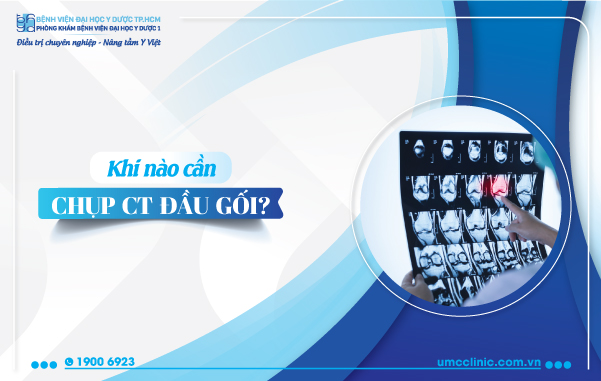 KHI NÀO CẦN CHỤP CT ĐẦU GỐI - NHỮNG ĐIỀU BẠN CẦN BIẾT