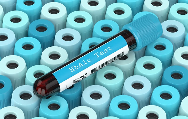 Xét nghiệm máu kiểm tra đường huyết Xet-nghiem-mau-kiem-tra-duong-huyet