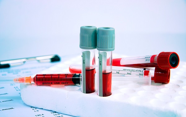 Xet-nghiem-mau-la-mot-phan-cua-kham-suc-khoe-tong-quat